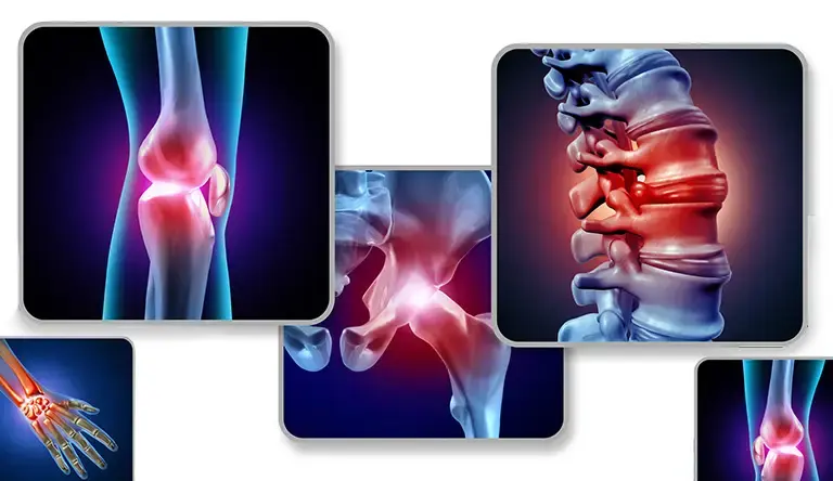 Top Treatments for Musculoskeletal Injuries