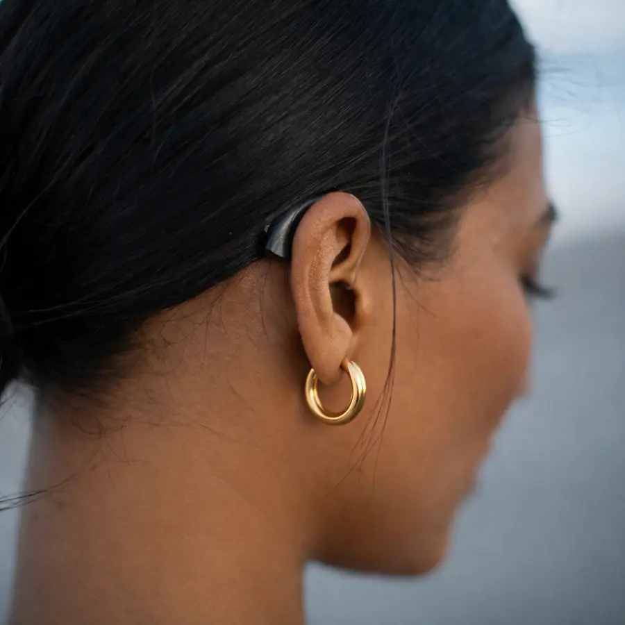 The Silence I Couldn’t Hide: Why Hearing Loss Forced Me to Redefine “Success” at 31