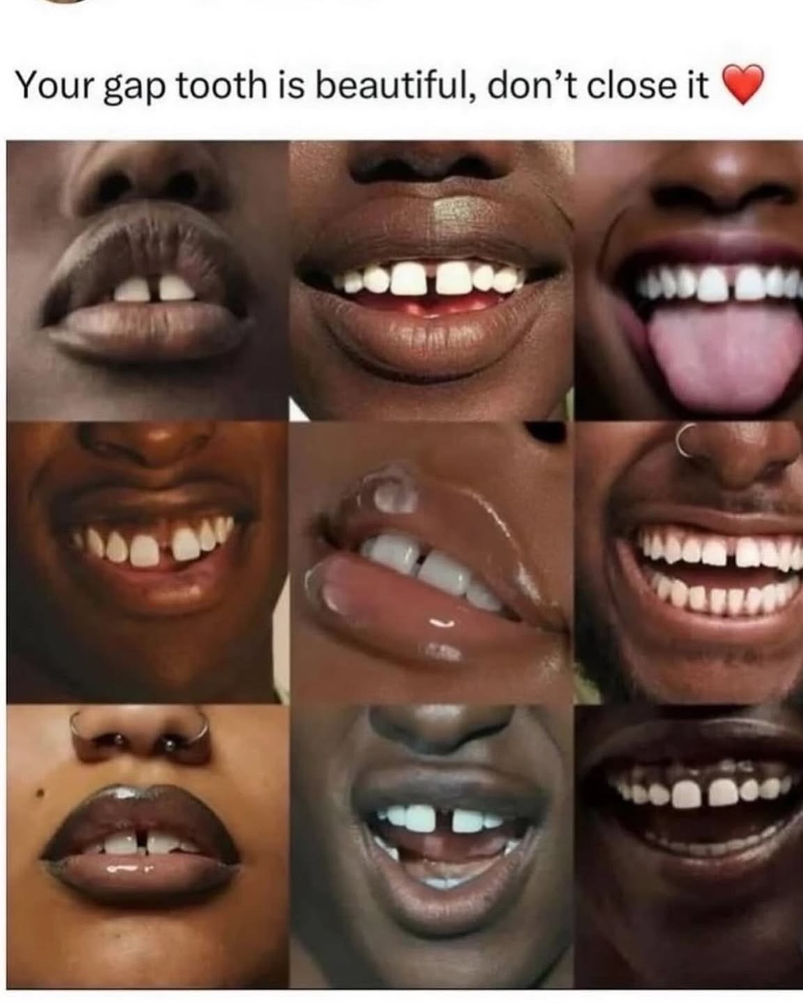 Journal Entry: Embracing My Gap