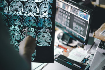 Understand your nervous system before it forces you to!